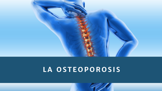 Remedios caseros para la Osteoporosis